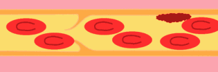 ʲôL(fng)